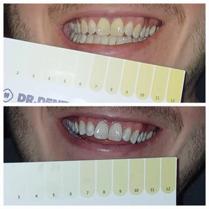 Kundin bei der Anwendung von Dr.Dent