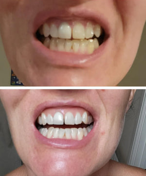 Kundin bei der Anwendung von Dr.Dent